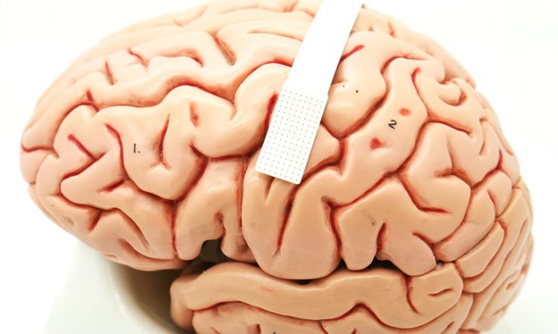 Moždani implantat otkriva što ćete reći Moždani implantat otkriva što ćete reći