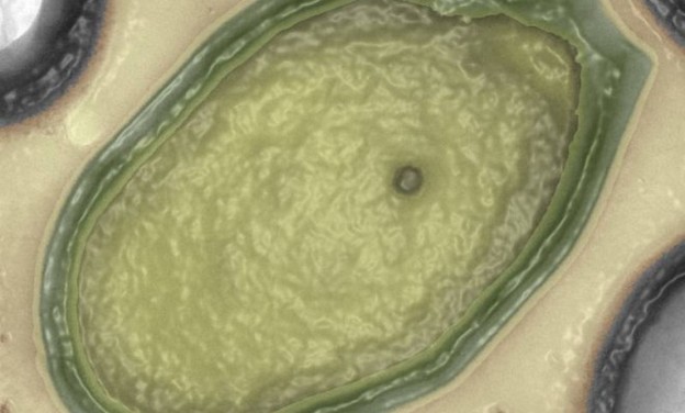 Najveći virus na svijetu Najveći virus na svijetu