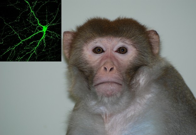 Neuroni nastali iz matičnih stanica Neuroni nastali iz matičnih stanica