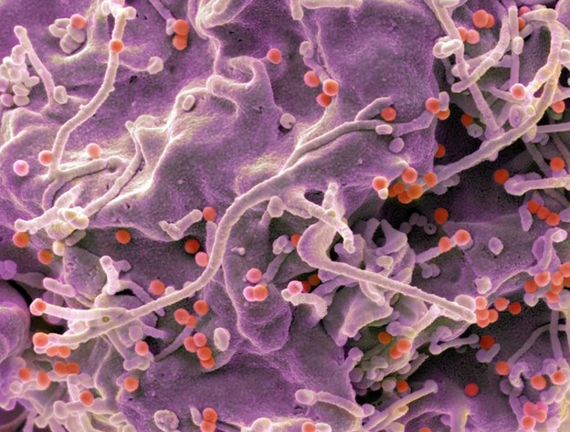 mRNA cjepiva za HIV pokazuju dobre rezultate